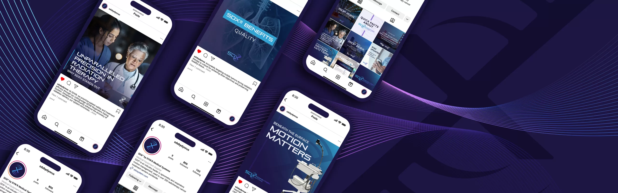 SDX System marketing materials social media